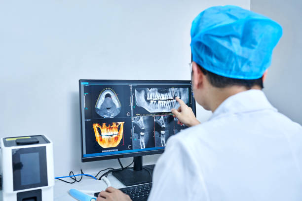 Best Dental Abscess Treatment in Ferdand, IN