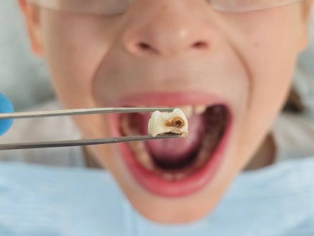 Best 24-Hour Emergency Dental Care in Ferdand, IN